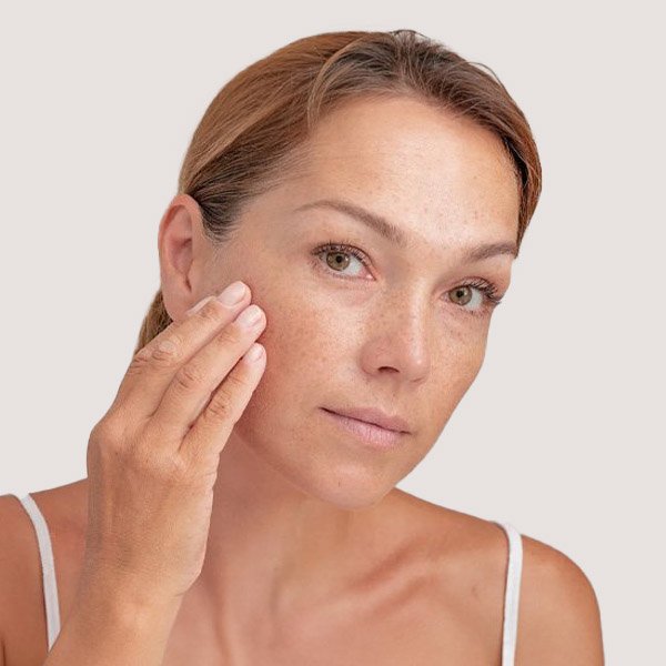 Tratamento de Melasma