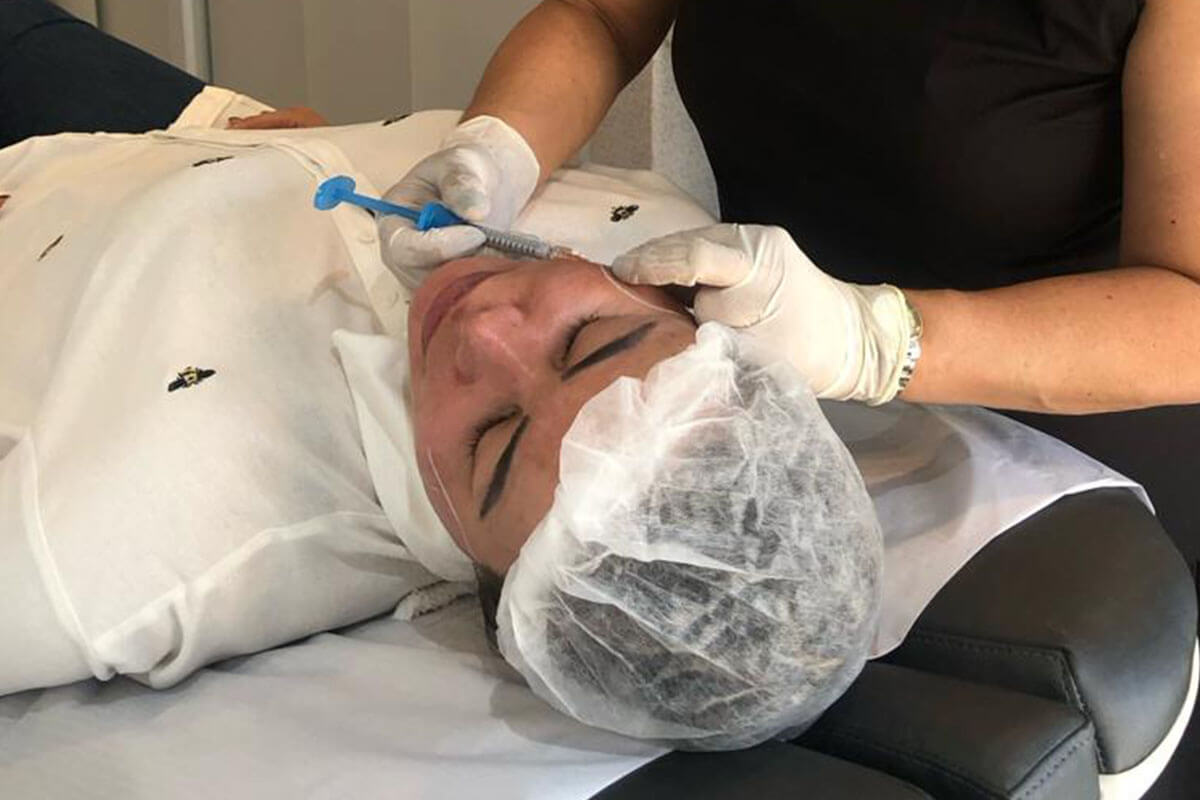 Bioestimuladores Dermatologista de SP